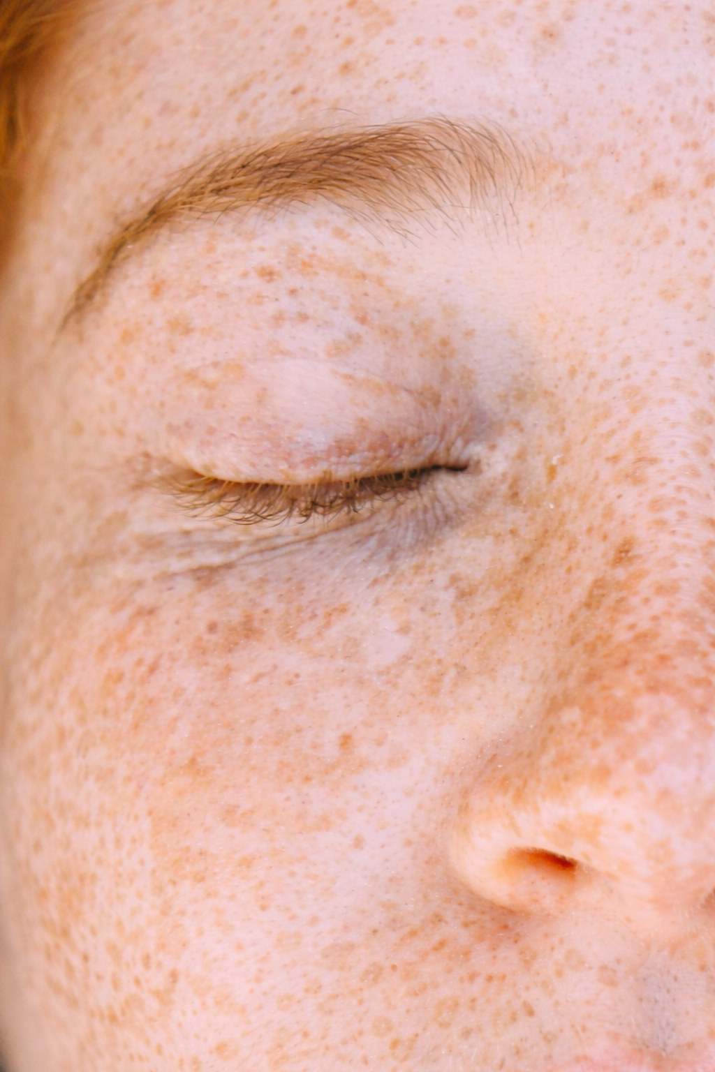 Sérum Anti-Tâches | Corrige les imperfections